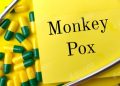 Monkeypox: Wabah Baru yang Mengintai, Ini yang Harus Kamu Tahu