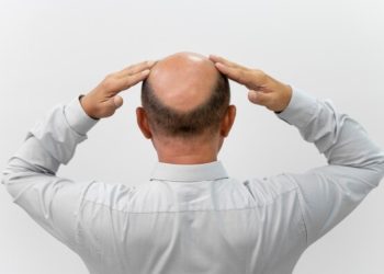 Rahasia Alami untuk Menumbuhkan Rambut Botak dengan Cepat dan Sehat