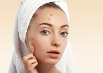 5 Bahan Alami Ampuh Hilangkan Jerawat: Solusi yang Wajib Kamu Coba