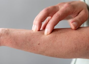 Kenapa Kulit Terasa Gatal di Malam Hari Tapi Tidak Bentol? Ini Penyebabnya