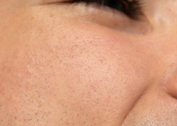 Tips Menyamarkan Pori-pori Wajah Secara Alami Tanpa Produk Mahal